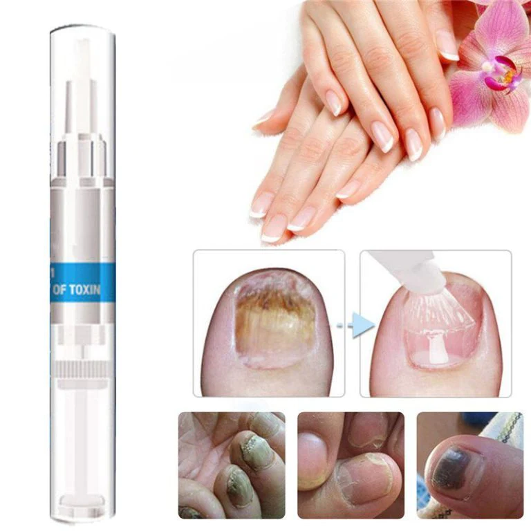 3PCS/1PC Nails Onychomycosis Repair Pen