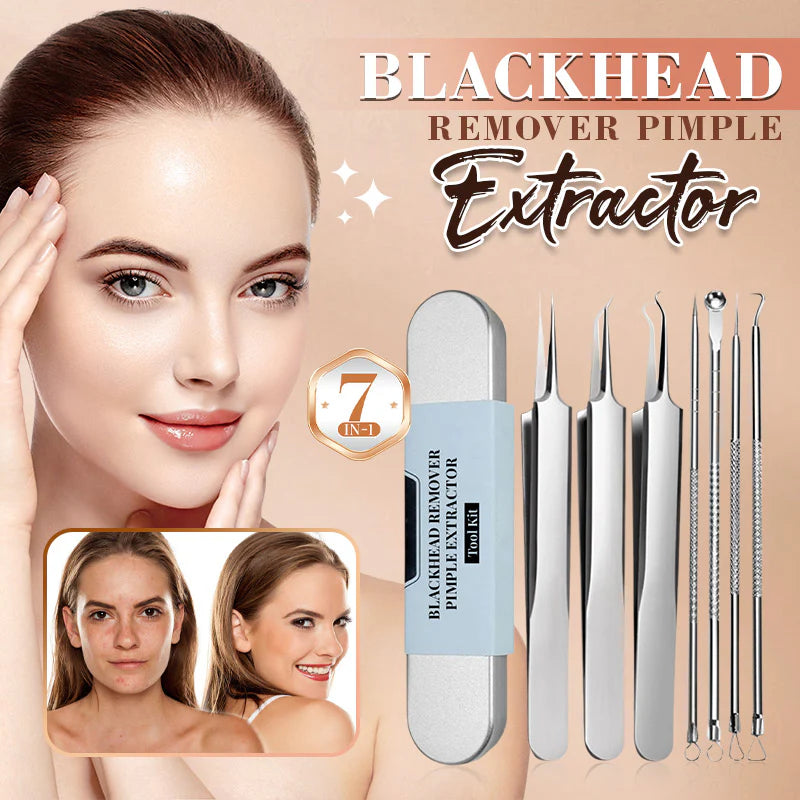 Stainless Steel Blackhead Remover Tool Kit 7-Piece Set Acne Needle Clip Blackhead Tweezer Beauty Tools