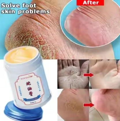 2Pcs Herbal Anti Crack Foot Cream Heel Cracking Repair Products Exfoliation Dead Skin Removal Softening Moisturize