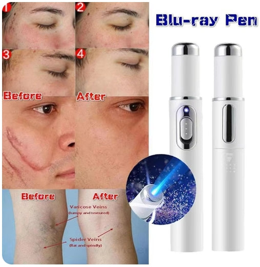 Blue Light Soft Scar Wrinkle Removal Pen