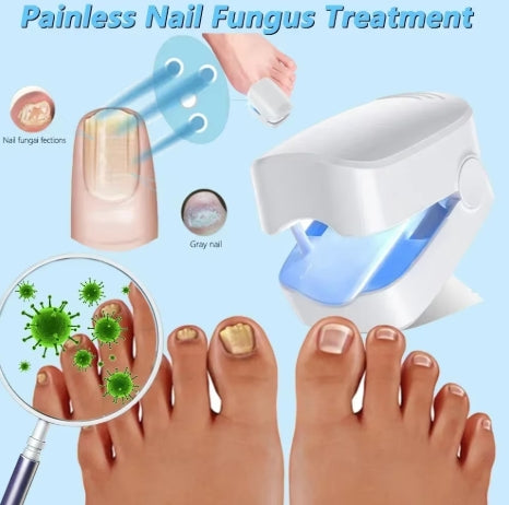 Nail Fungus Laser Treatment Device Repair Toenail Fingernail Fungus Treat Onychomycosis Therapy Cure Machine Effectively Remove