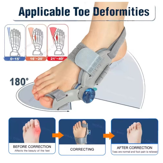 Adjustable Unisex Bunion Corrector Foot Hallux Valgus Braces Rotatable Toe Separator Straightener Adjustable Pedicure Finger Toe Corrector