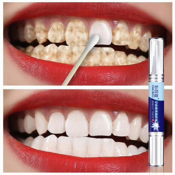 4Pcs Instant Whitening Oral Pen Teeth Repair Whitening Pen