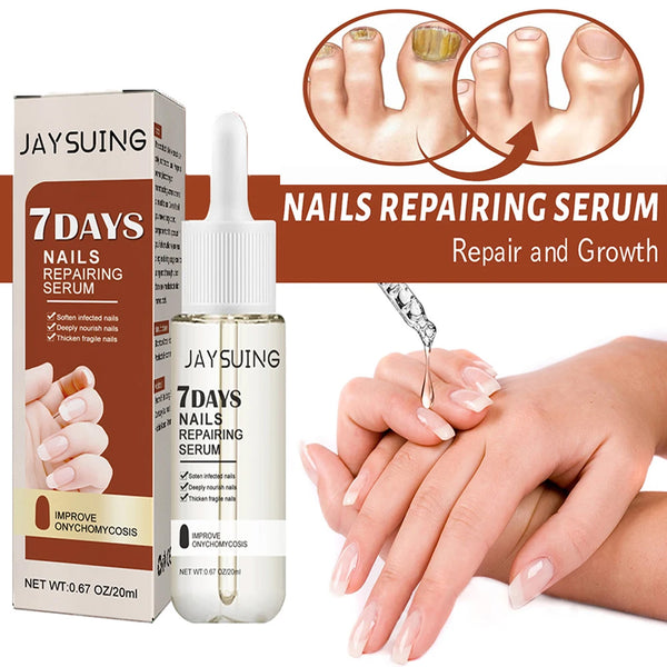 20ml Nail Cuticle Nutrient Oil Nourish Repair Damaged Nail Care Nutrition Oil Treatment Moisturizes Strengthen Bright for Nails