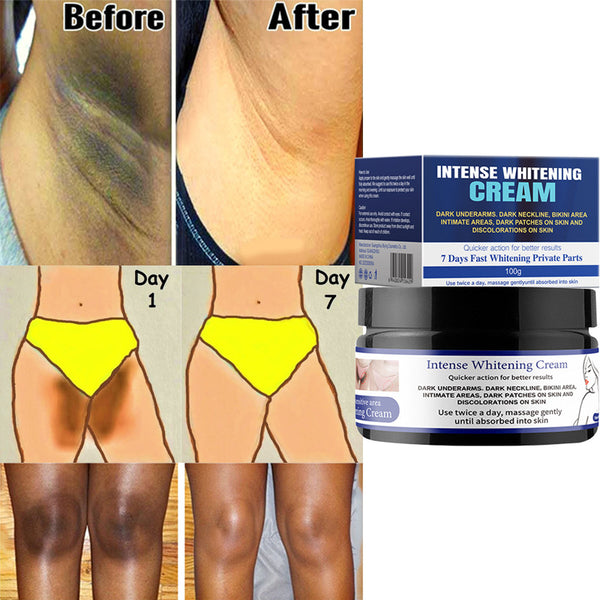 7 Days Whitening Cream Underarm Cream Moisturizing Concealer Body Sensitive Part Brightening Cream for Knees Elbows Dark Spot