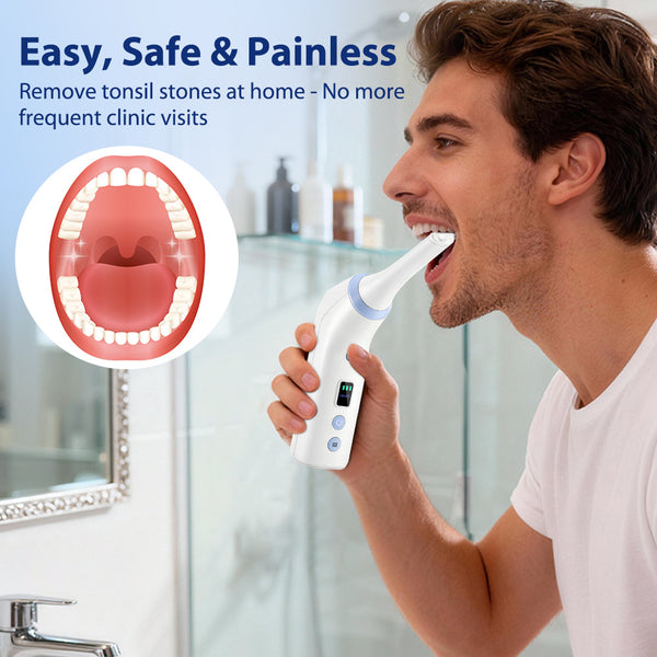 Home-Use Electric Tonsil Stone Remover | 3-Speed Adjustable Suction + LED Lighting | Wireless Charging and Portable Design