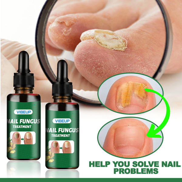 2Pcs VIBEUP Nail Fungus Treatment Serum — Visible results in 7 days, powerfully repairs the nail bed, banishing onychomycosis, paronychia and recurrent infections
