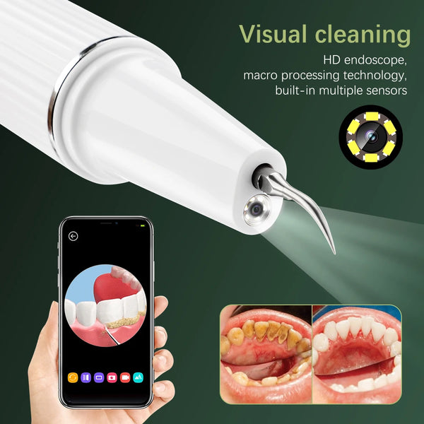 Visual Electric Ultrasonic Dental Scaler with Camera Calculus Oral Tartar Remover Tooth Stain Cleaner Teeth Whitening Oral Care