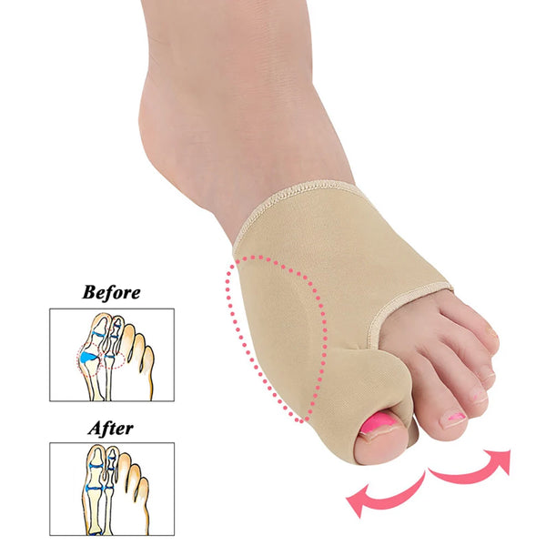 1Pair Upgraded Bunion Corrector for Women & Men | SEBS Hallux Valgus Splint | Big Toe Separator | Breathable Foot Sleeve for Day & Night Use