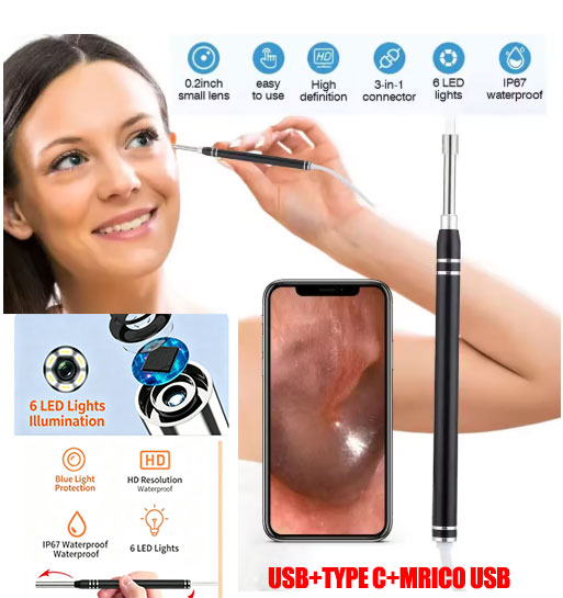 Phone Smart Visual Ear Cleaner | Universal with Three Ports (USB + Type-C + Micro USB) | High-Definition Endoscope | IP67 Waterproof