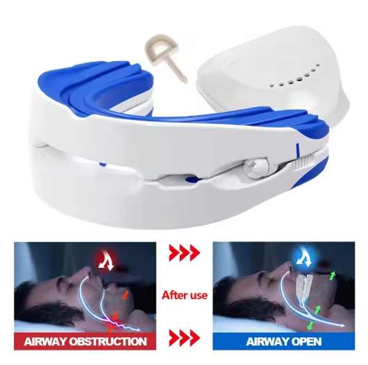 Adjustable Anti-Snoring Mouthpiece Nighttime Teeth Guard Sleep Mouthguard for Bruxism - Snoring Device for Better Rest