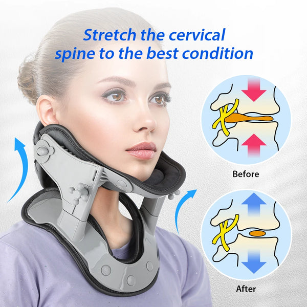 Electric Heating Neck Stretcher Medical Cervical Traction Device Heat Treatment Neck Massager Neck Correction Repair Relieve Neck Pain