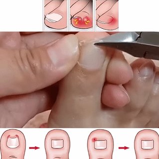 Carbon Steel Nail Clipper Cutter Professional Manicure Trimmer High Quality Toe with Clip Catcher False Nail Tips