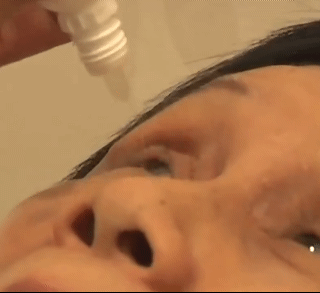 1PC Professional Universal Eye Drop Keeper Eye Drop Bottle Helper Eyedrops Holder