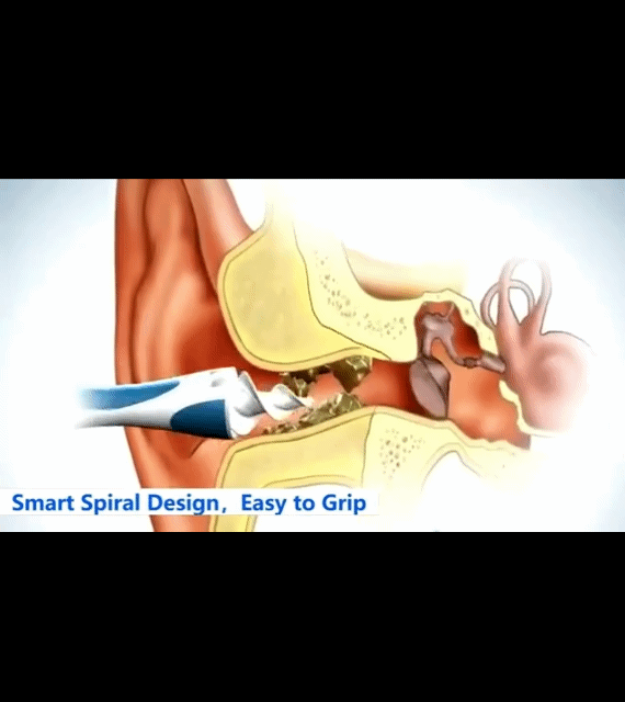 Spiral Ear Oil Remover Portable Soft Ear Oil Remover For Adults And Children Ear Wax Cleaning Tool 16 Head Ear Wax Cleaning Tool