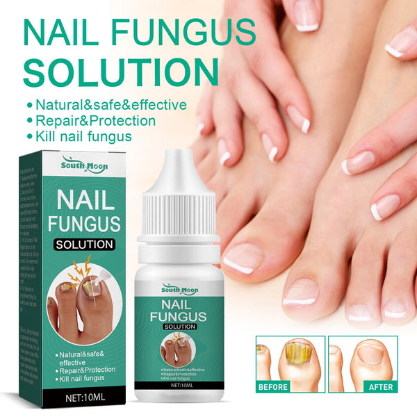 1/2/4PCS Nail Fungus Solution Serum Ingrown Toenail Fungal Treatment Essence Anti Infection Remove Nail Cuticle Feet Care 10ml