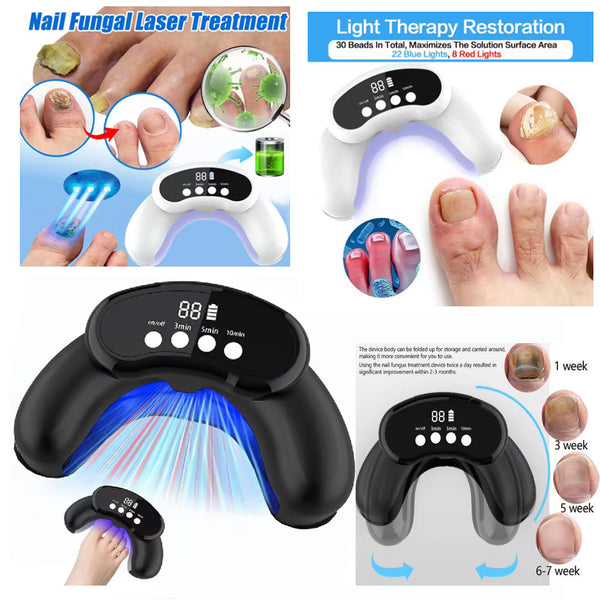 45W Nail Fungus Treatment Device Antifungal Repair Pen Blue Light Laser Pen Paronychia & Onychomycosis Painless Removal & Care 30 Rechargeable LEDs 470nm & 905nm Blue Light with Digital Display