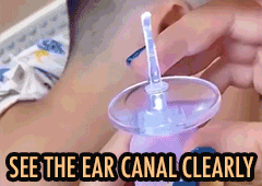 ﻿3-In-1 Baby Child Adult Earpick LED Ear Scoop with Magnifier Pluck the  ear wax with ease harmless