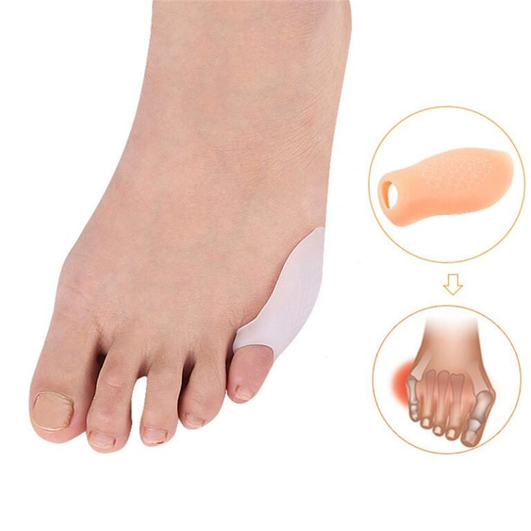 2PCS Relax Toe Separators
