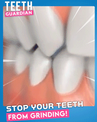 2Pcs Teeth Guardian No more Grind