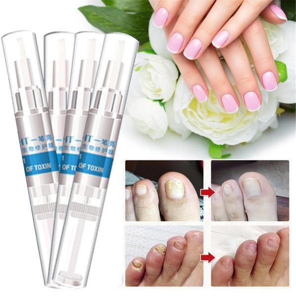 4pcs 3ml Nail Treatment Pen Infection Nail Bright Pencil Fungal Treatment Anti Fungus Biological Repair Restores Healthy Nails
