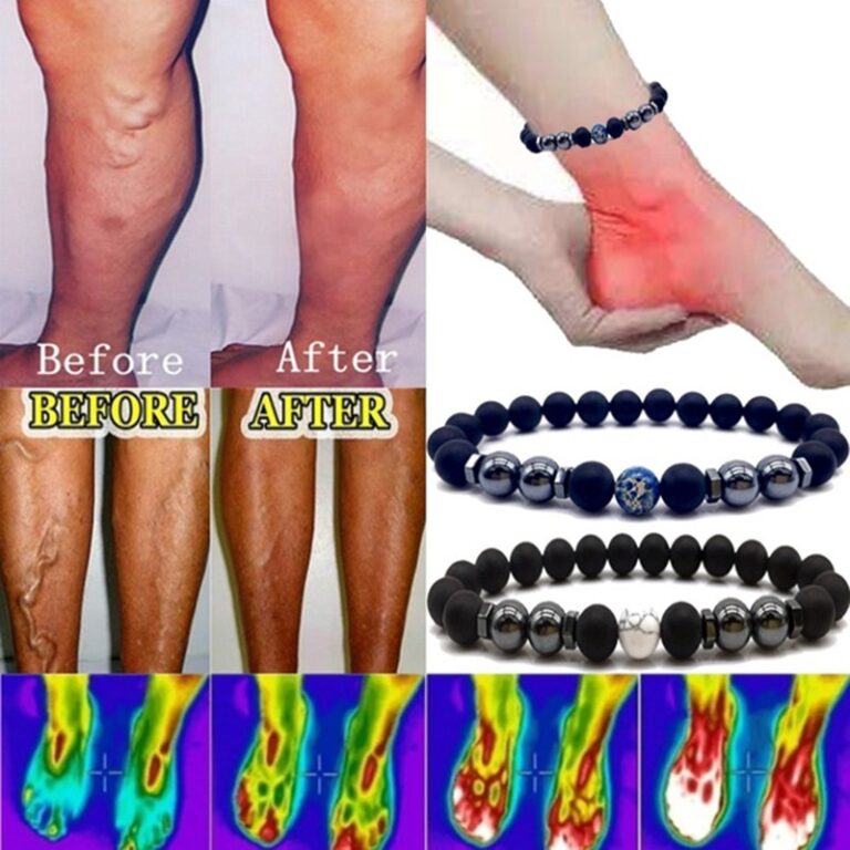 Magnetic Anklet Auxiliary Anti Varicose And Swelling Magnetotherapy Anklet