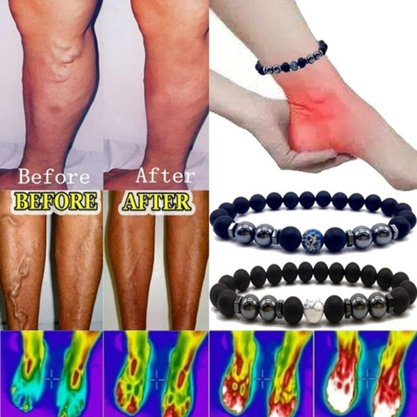 Magnetic Anklet Auxiliary Anti Varicose And Swelling Magnetotherapy Anklet