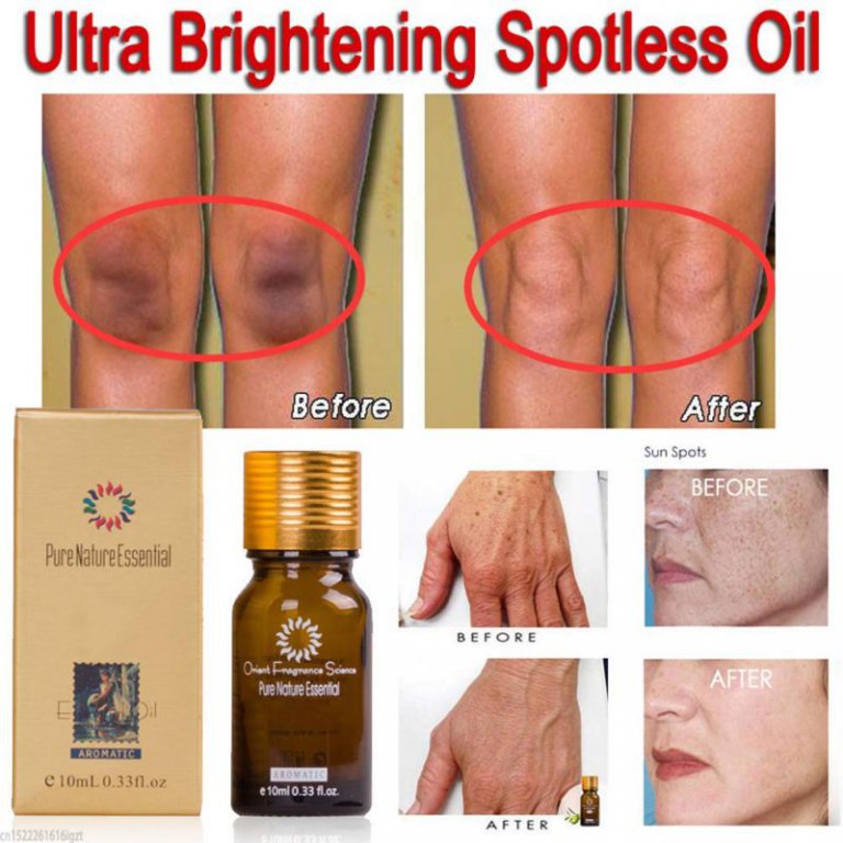 2x Spotless Skin Brightening Oil