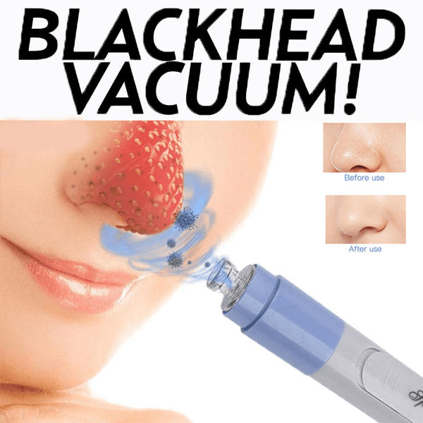 Blackhead Vacuum