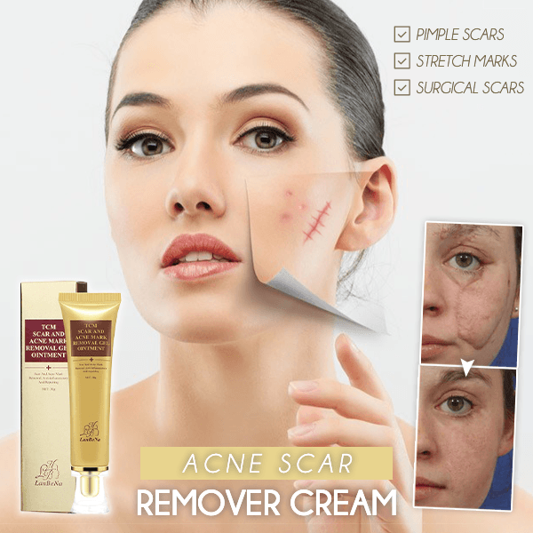 Acne Scar Remover Cream