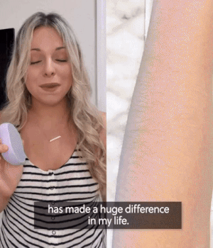 Crystal Hair Eraser Hair Removal Device  Exfoliator Physical depilation